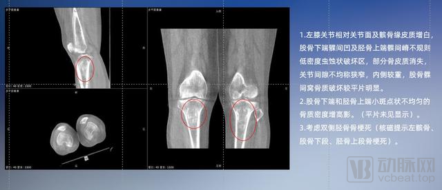 摄影设备什泛亚电竞么是摄影设备？的最新报道(图3)